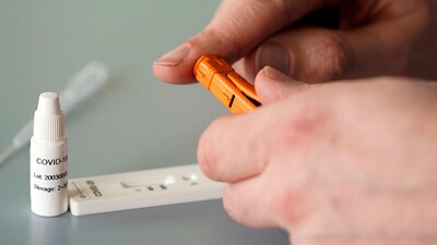 Antikor oluşması ne demek?