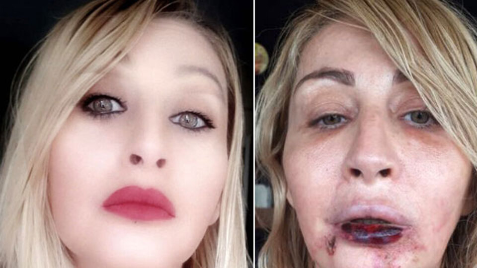 Estetik faciasında önemli gelişme!