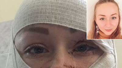 Boşanmak istemişti! "Yüzümü geri istiyorum!"