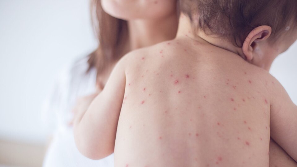 Su çiçeğine ne iyi gelir?