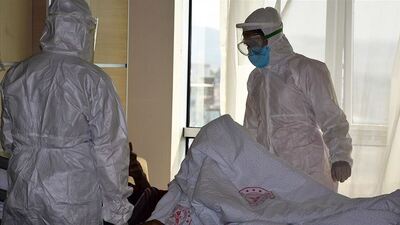 "Sitokin fırtınası"nı önlemek için ilaç çalışmaları yapılıyor