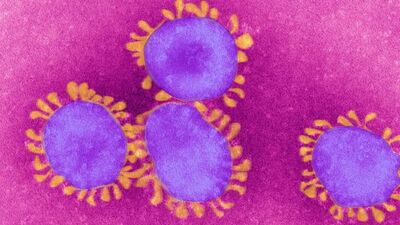 Sitokin fırtınası nedir?