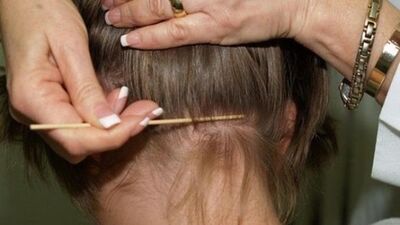 Çocuklu ailelerin korkulu rüyası: Bitler nasıl oluşur?