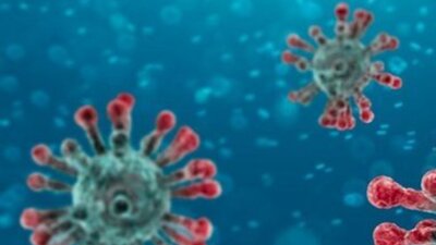 Bu belirtiler varsa koronavirüssünüz!