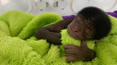 650 gram olarak doğdu... Fenomen oldu