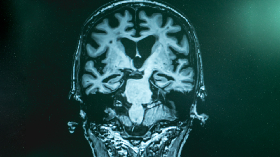 Bir damla kandan teşhis edilecek!