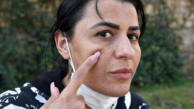 Hayatının kabusunu yaşadı!