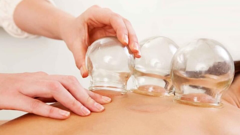 Hacamatın faydaları nelerdir?