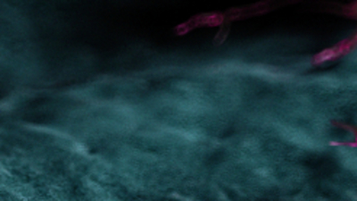 Korkunç uyarı! 'Muhtemel kanserojen kaynağı'