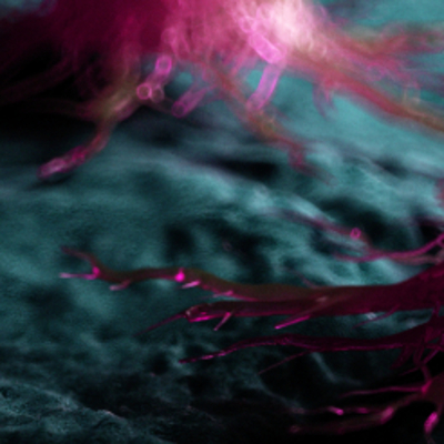 Korkunç uyarı! 'Muhtemel kanserojen kaynağı'