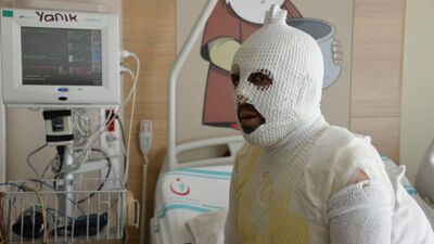 Tacizle suçlandı! Kaynar suyla haşlandı!