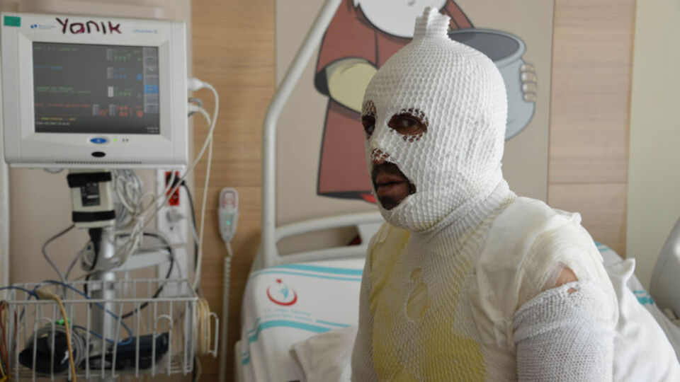 Tacizle suçlandı! Kaynar suyla haşlandı!