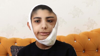 Her şey bir şişlikle başladı!