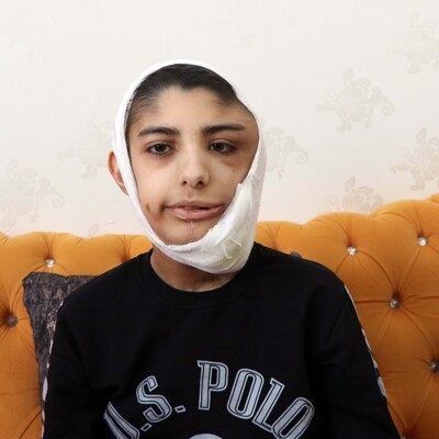 Her şey bir şişlikle başladı!