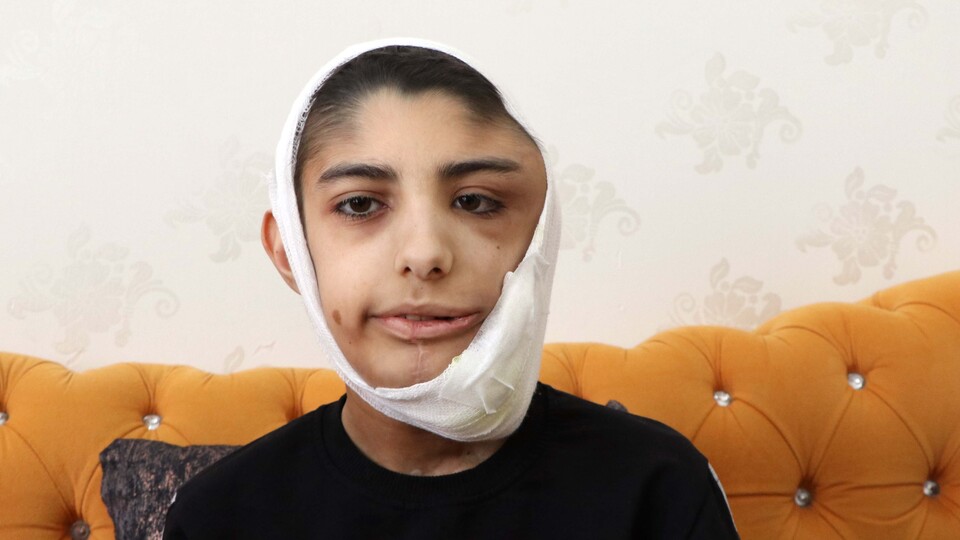 Her şey bir şişlikle başladı!