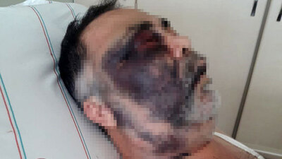 Engelli adam ve ailesine feci darp! İğrenç tehdit!