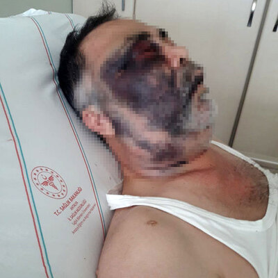 Engelli adam ve ailesine feci darp! İğrenç tehdit!