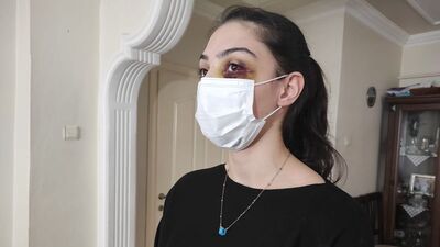 Video izlediği için feci darp!