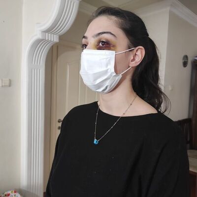 Video izlediği için feci darp!