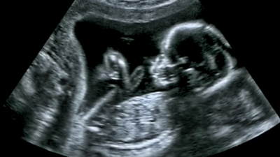 İnsan nesli tehlikede! 2045 yılına vurgu