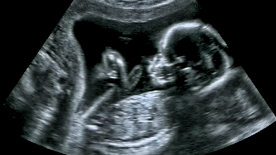 İnsan nesli tehlikede! 2045 yılına vurgu