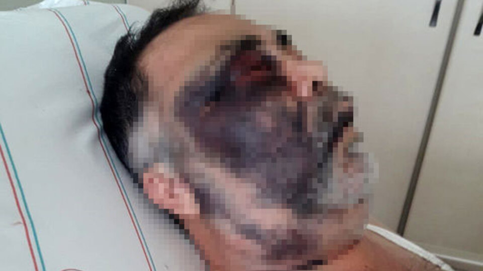 Engelli adama saldırıdan acı haber!