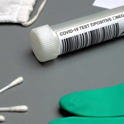 Tokyo hükümetinden Pekin'e: "Anal Kovid-19 testi istemiyoruz!"