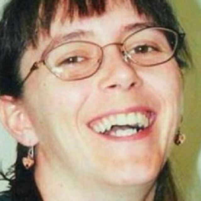 2013'te yüz nakli olan kadında doku uyuşmazlığı olunca...