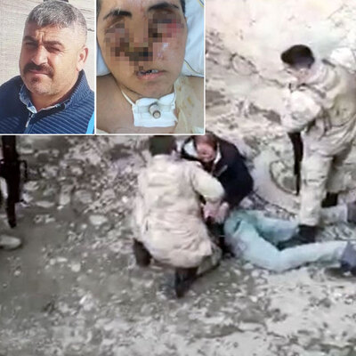 Yüzü tanınmayacak halde! "Bana yardım edin!"