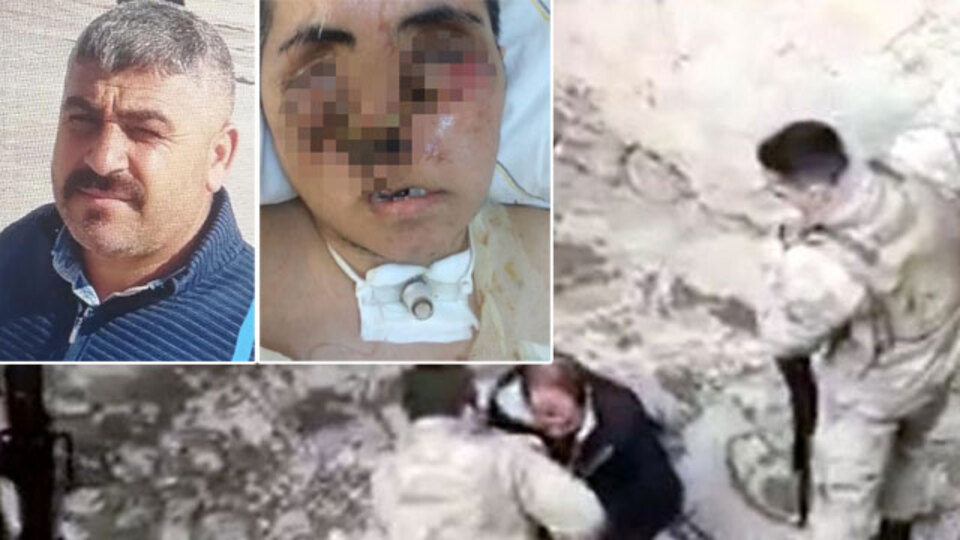 Yüzü tanınmayacak halde! "Bana yardım edin!"