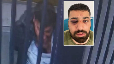 "Polis defalarca başıma vurdu" dedi! Görüntüler şoke etti!