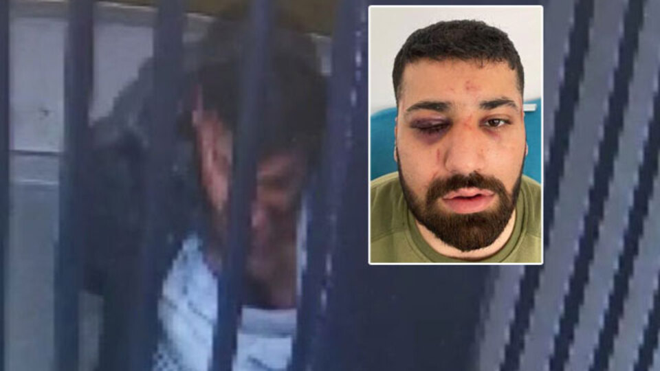 "Polis defalarca başıma vurdu" dedi! Görüntüler şoke etti!