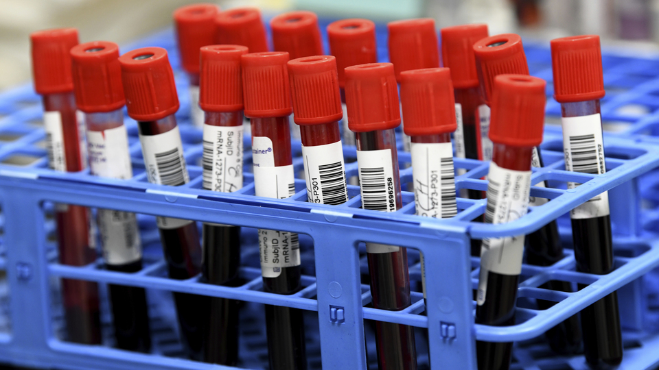 Koronavirüste mutant uyarısı!