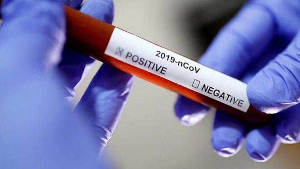 Corona virüs belirtileri nedir?