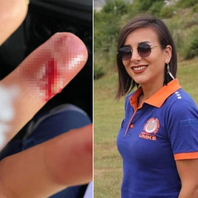 Sağlıkçıya saldırı! Parmakları kopuyordu!