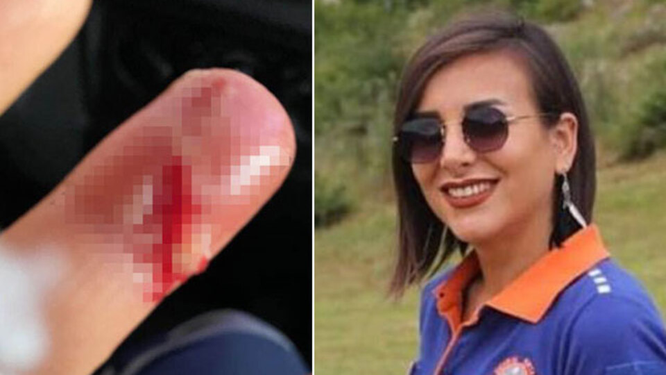 Sağlıkçıya saldırı! Parmakları kopuyordu!