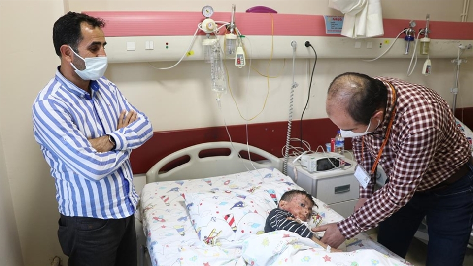 Kelebek hastalarının umudu oldular