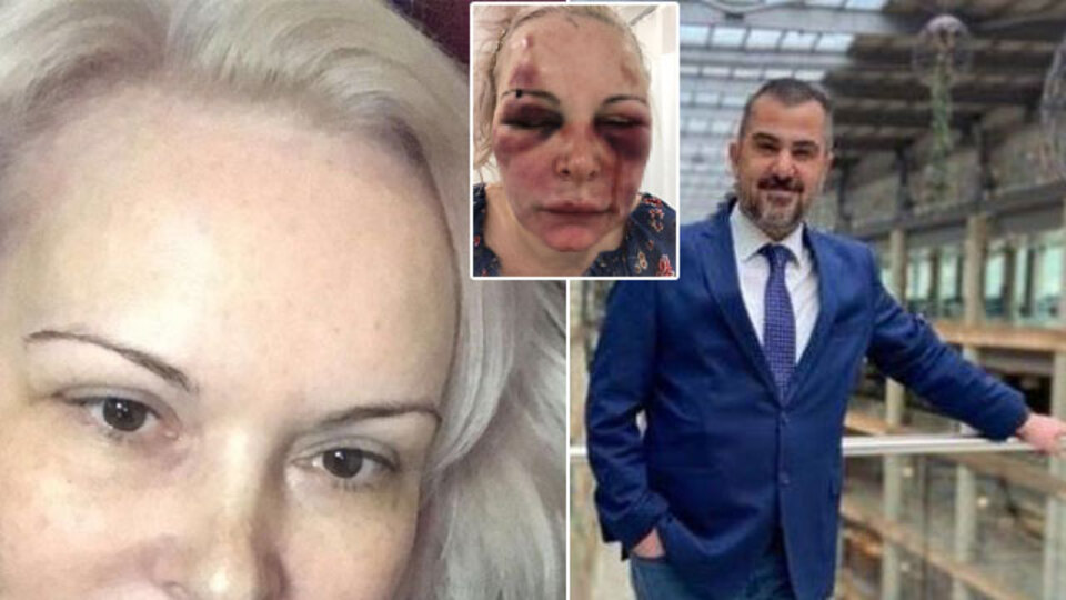 Tam 2 gün sürdü! Rus sevgilisine dehşeti yaşattı!