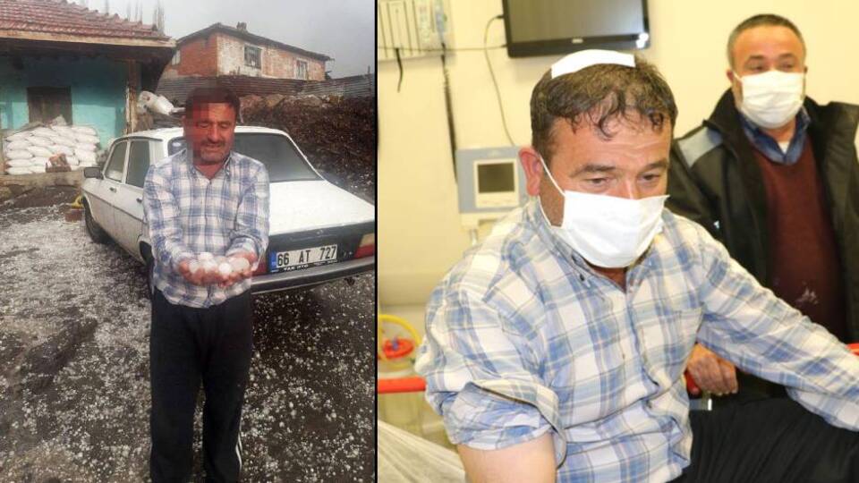 Yumurta büyüklüğündeki dolu hastanelik etti