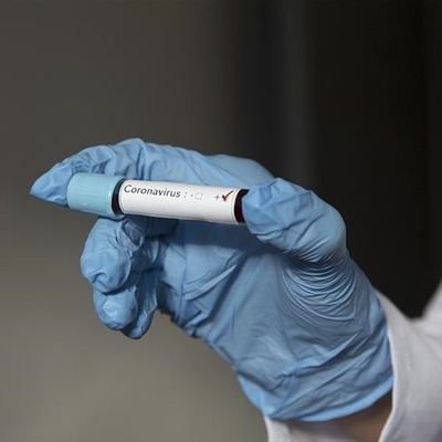 Covid-19'a bağlı yeni hastalık!