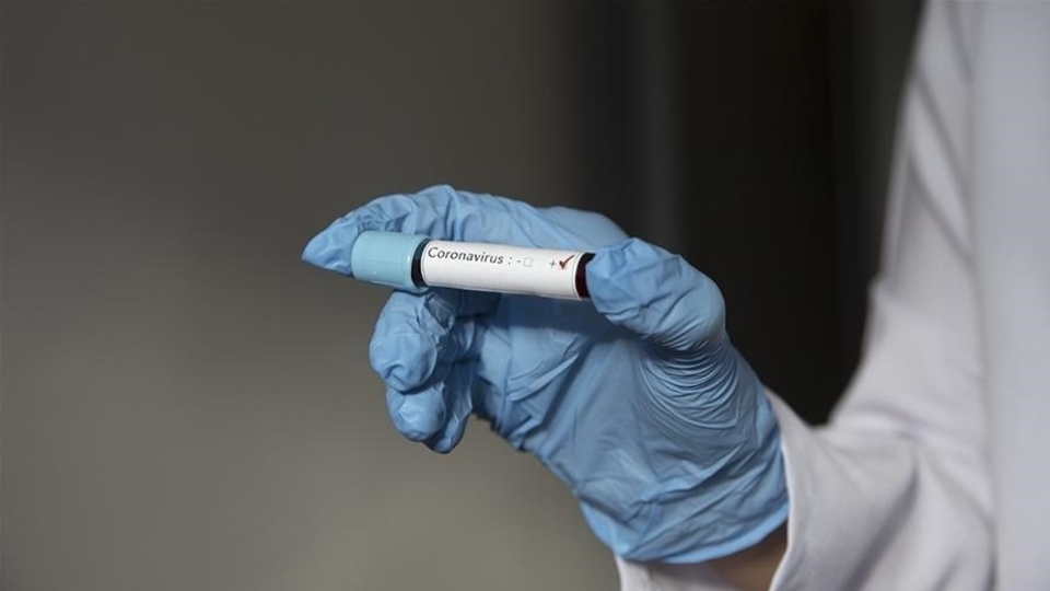 Covid-19'a bağlı yeni hastalık!