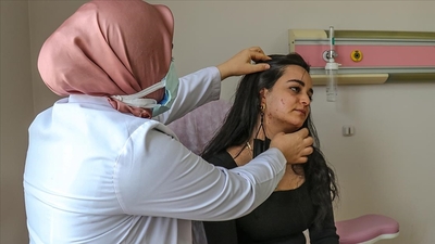 Covid'i atlatanlarda saç dökülmesi!