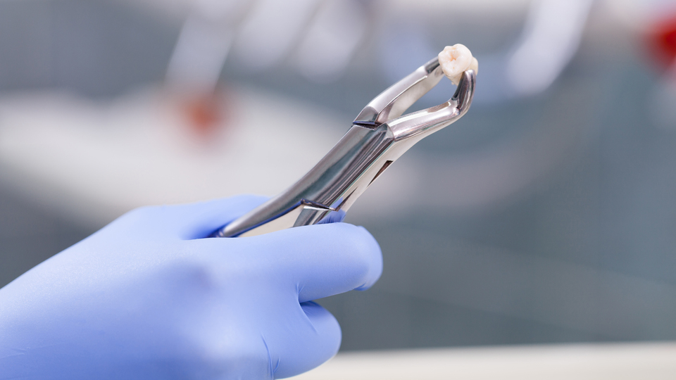 Araştırmacılar dişleri yeniden çıkarmanın yolunu buldu