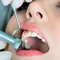 Diş temizletmek orucu bozar mı?