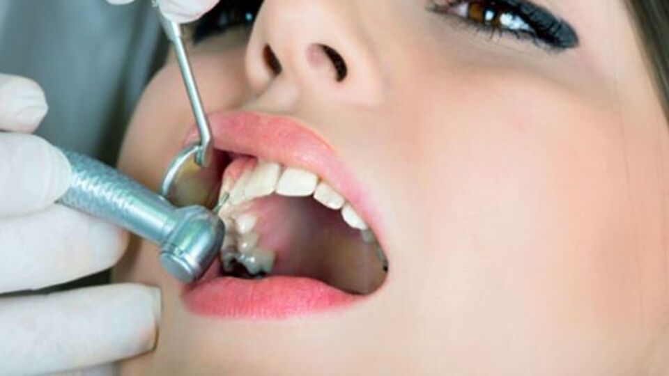 Diş temizletmek orucu bozar mı?