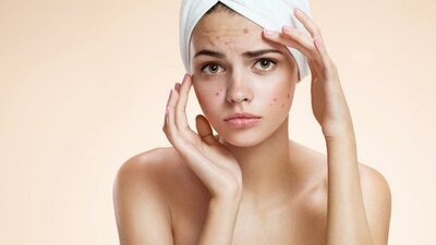 Sivilce patlatmak orucu bozar mı?