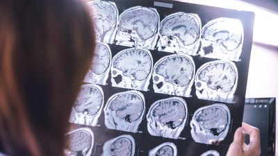 Demans teşhisi konulursa işte sorulması gereken 7 soru