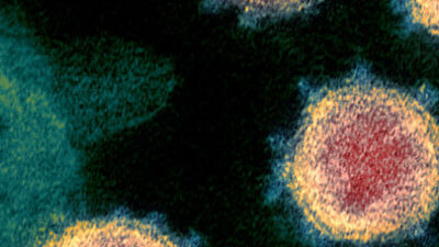 "İngiliz varyantı 1,32 kat daha bulaşıcı"