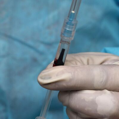 Bilim Kurulu Üyesi Kara'dan çocuklarda aşı açıklaması