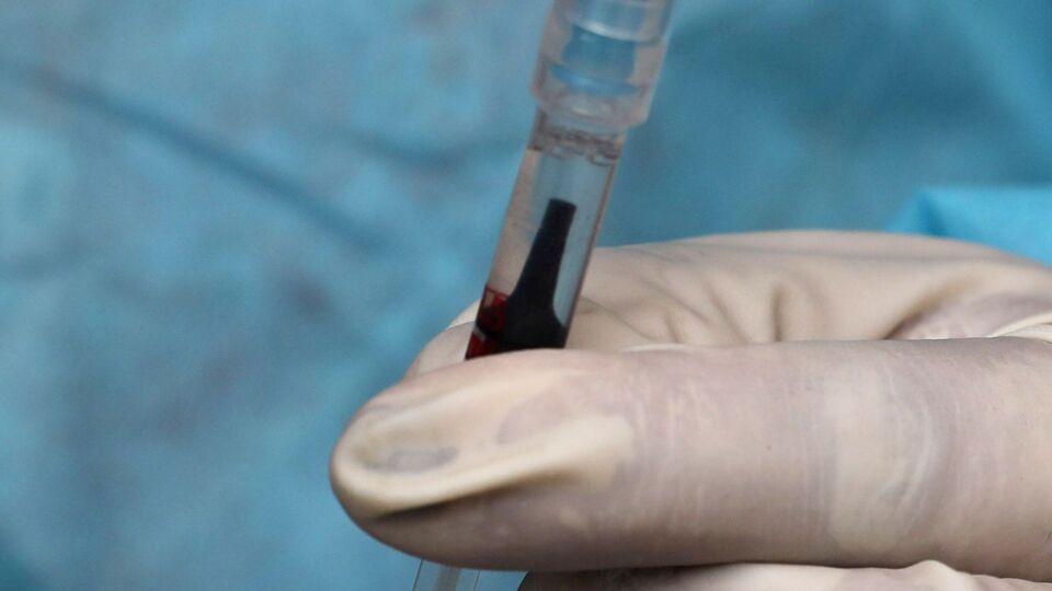 Bilim Kurulu Üyesi Kara'dan çocuklarda aşı açıklaması